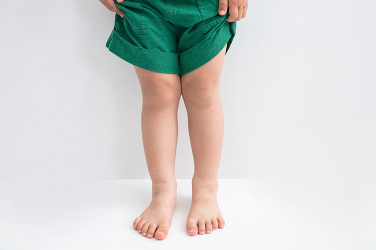 小児整形外科イメージ